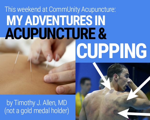 Trying out integrative medicine, Neurologist Timothy Tim J. Allen, MD from Neurology Specialists of the Rockies checks out different methods to pain management, such as Chinese cupping myofascial release, acupuncture like Olympics Michael Phelps swimmer